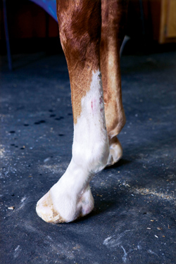 Barefoot at discharge