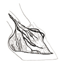 Venogram 1:1