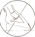 Venogram 1:3