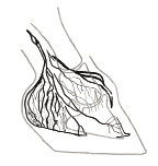Venogram: Folded LCJ