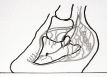 Figure 8b