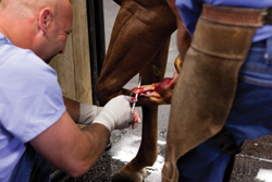 Tenotomy