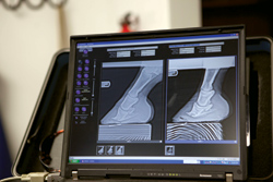 X-rays before and after