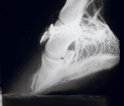 Venogram  image of hoof
