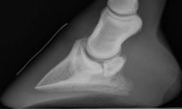 radiograph