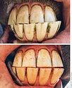 G1_Tooth+Hoof.jpg