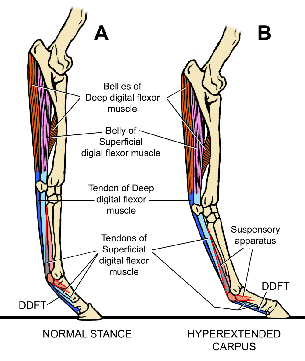 Fig 03 Anatomy Tendons carpal hyperextension sm2.jpg