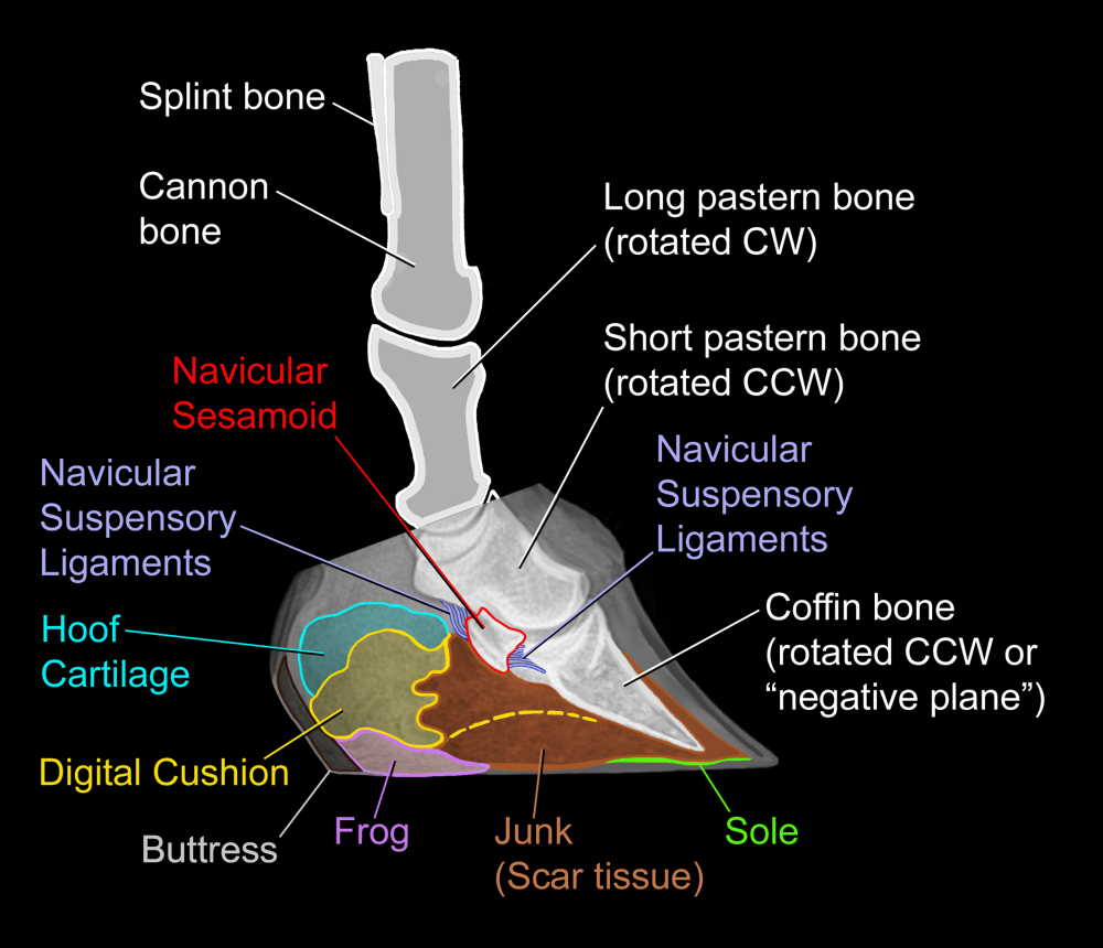 Fig 14 Reversal coffin bone rotn after removal sm2.jpg