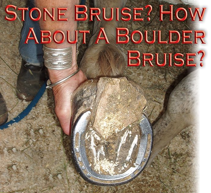 Stone Bruise? How About A Boulder Bruise?