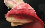 08_Mike-Savoldi-Pathologies-of-the-Hind-Foot_0213.jpg