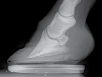 Silverman-radiograph.jpg