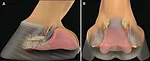 Understanding-the-Digital-Cushion_Fig-1a-1b.jpg