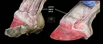 Understanding-the-Palmar-Digital-Nerve_art.jpg