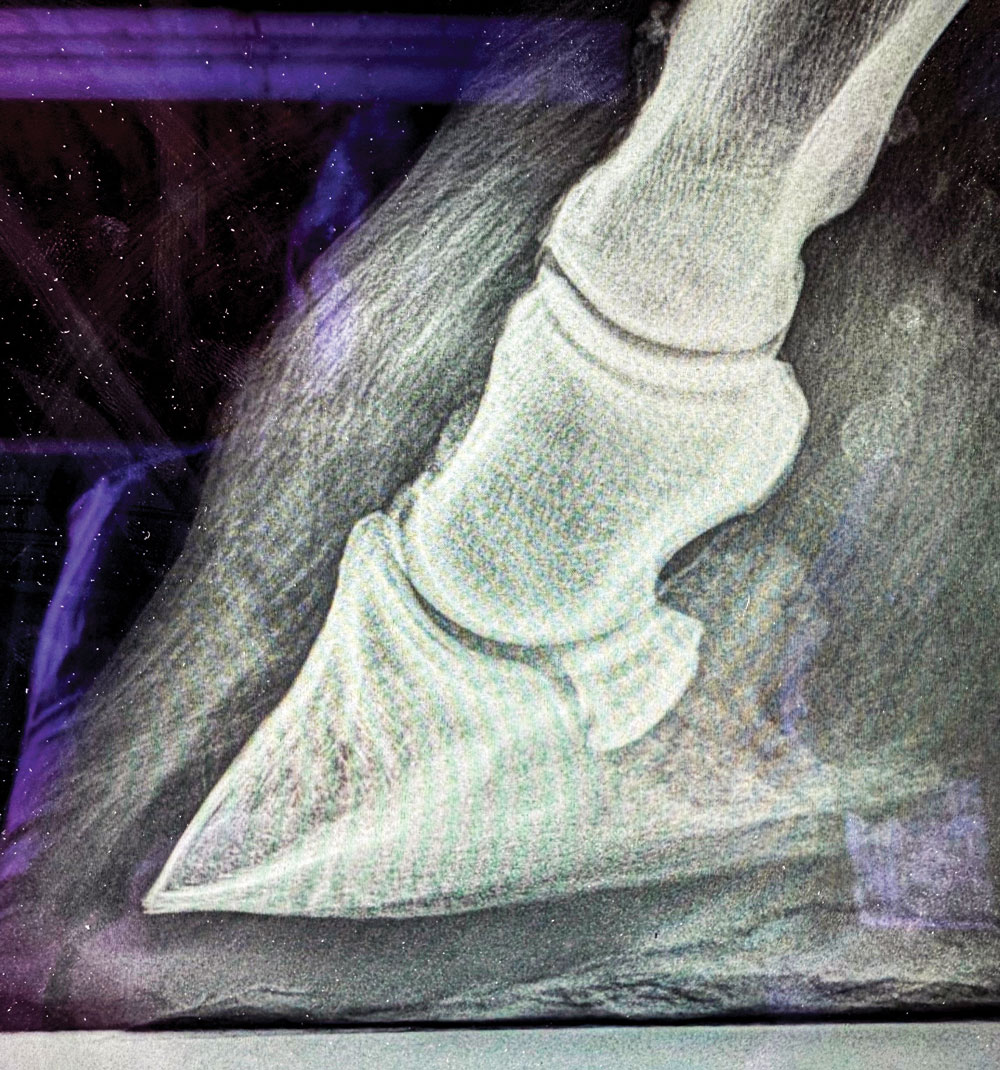 Radiographic-Findings--a-Simplified-Reset-2.jpg