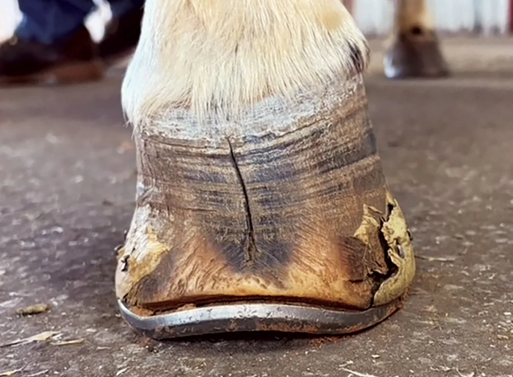 A Biomechanical Approach to Managing Club Feet-Fig-1.jpg