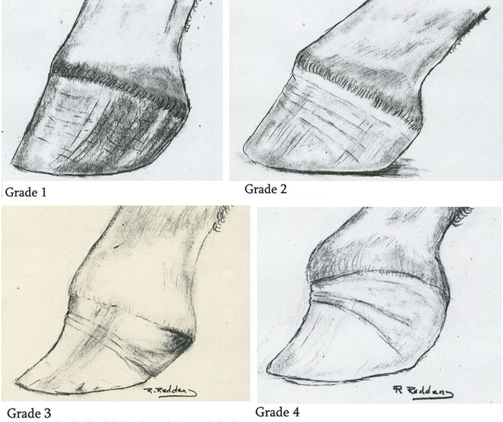 A-Biomechanical-Approach-to-Managing-Club-Feet-Fig-4.jpg