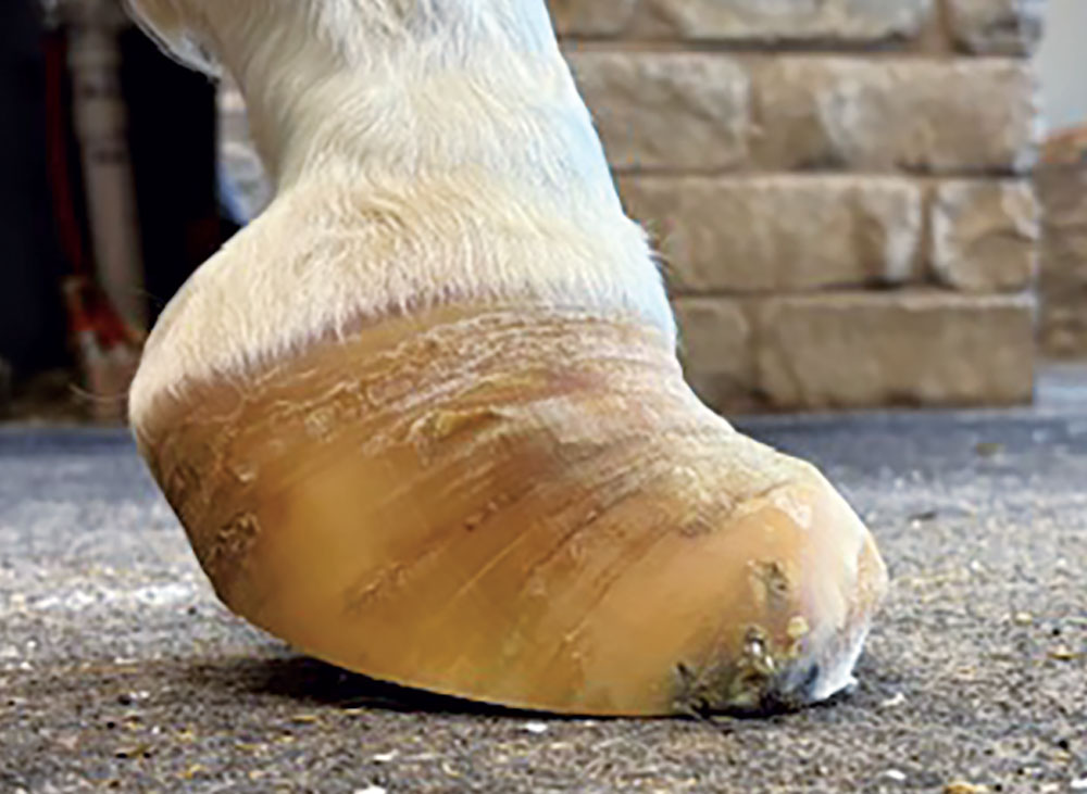 A-Biomechanical-Approach-to-Managing-Club-Feet-Fig-5.jpg