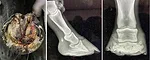 Osteomyelitis_AFJ_1126-1.jpg
