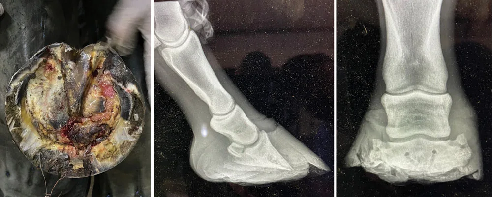 Osteomyelitis_AFJ_1126-1.jpg