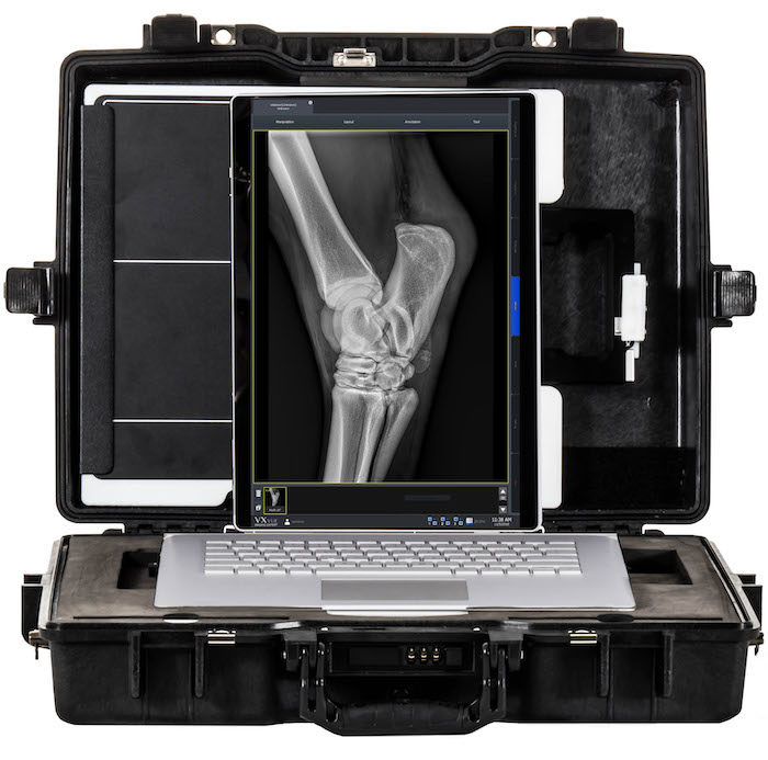 Sedecal USA WEPX-V10 Portable Digital X-Ray Imaging System_0320 copy
