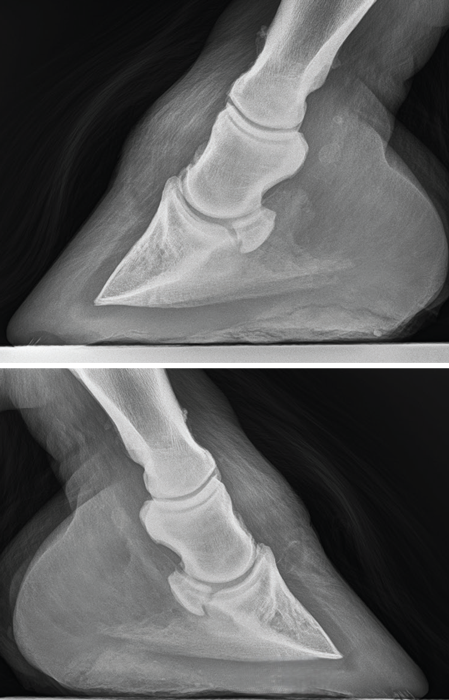 Sidebone-unchanged-Xray
