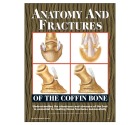 Anatomy And Fractures Of The Coffin Bone